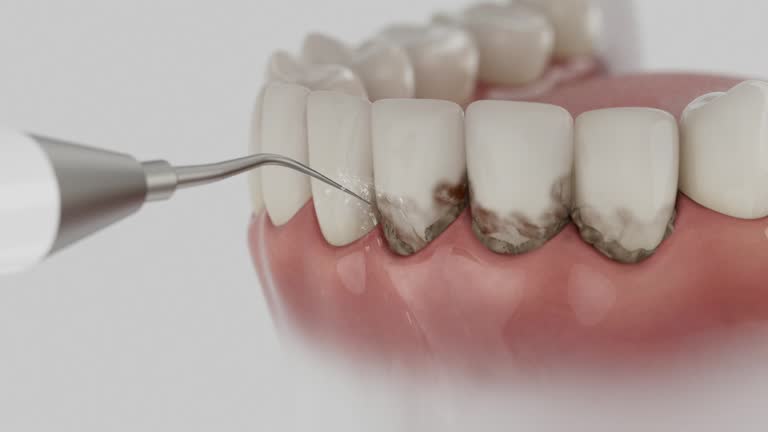 Trusted Teeth Cleaning And Checkup service in North Ballston Spa, NY - Dentist Open Now